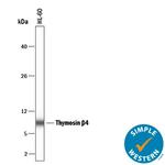 TMSB4X Antibody in Western Blot (WB)