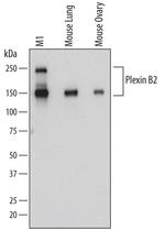 PLXNB2 Antibody in Western Blot (WB)