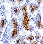 Folate Receptor alpha Antibody in Immunohistochemistry (Frozen) (IHC (F))