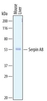 Angiotensinogen Antibody in Western Blot (WB)