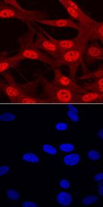 ARX Antibody in Immunocytochemistry (ICC/IF)