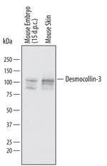 Desmocollin 3 Antibody in Western Blot (WB)