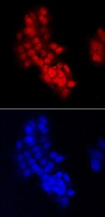 CHD7 Antibody in Immunocytochemistry (ICC/IF)