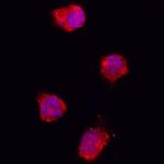 IL1RA Antibody in Immunocytochemistry (ICC/IF)