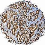 ADAM15 Antibody in Immunohistochemistry (Paraffin) (IHC (P))