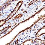 Cathepsin L Antibody in Immunohistochemistry (Paraffin) (IHC (P))