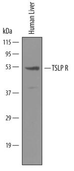 TSLP Receptor Antibody in Western Blot (WB)