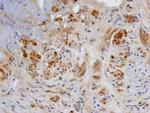 BMP-3 Antibody in Immunohistochemistry (Paraffin) (IHC (P))