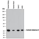 Carbonic Anhydrase II Antibody in Western Blot (WB)