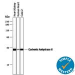 Carbonic Anhydrase II Antibody in Western Blot (WB)