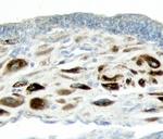 ADAMTS1 Antibody in Immunohistochemistry (Paraffin) (IHC (P))