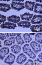 PRSS3 Antibody in Immunohistochemistry (Frozen) (IHC (F))