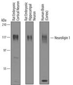 Neuroligin 1 Antibody in Western Blot (WB)