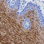 TGM3 Antibody in Immunohistochemistry (Paraffin) (IHC (P))