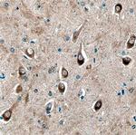 STX8 Antibody in Immunohistochemistry (Paraffin) (IHC (P))