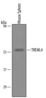 HBEGF Antibody in Western Blot (WB)