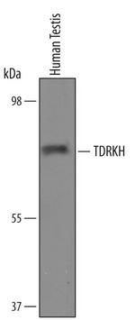 TDRKH Antibody in Western Blot (WB)