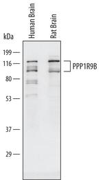 PPP1R9B Antibody in Western Blot (WB)