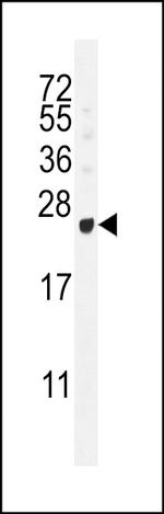 GAGE12B Antibody in Western Blot (WB)
