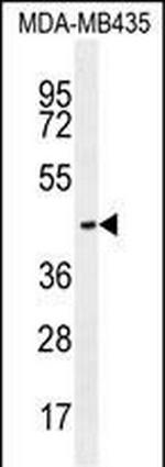 OR2L13 Antibody in Western Blot (WB)