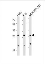 RAB12 Antibody in Western Blot (WB)