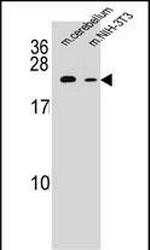 RAB12 Antibody in Western Blot (WB)