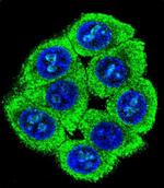 PATL2 Antibody in Immunocytochemistry (ICC/IF)