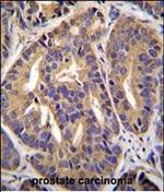 GTF2H2C Antibody in Immunohistochemistry (Paraffin) (IHC (P))