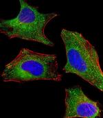 DHCR7 Antibody in Immunocytochemistry (ICC/IF)