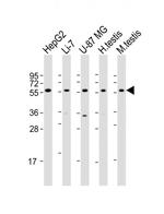 DHCR7 Antibody in Western Blot (WB)