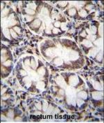 CACNG8 Antibody in Immunohistochemistry (Paraffin) (IHC (P))