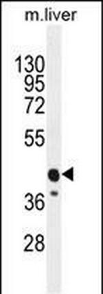 CACNG8 Antibody in Western Blot (WB)