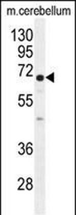 UGT8 Antibody in Western Blot (WB)