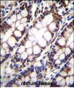 UQCRFS1 Antibody in Immunohistochemistry (Paraffin) (IHC (P))