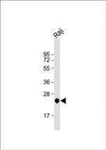 UQCRFS1 Antibody in Western Blot (WB)