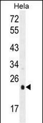 UQCRFS1 Antibody in Western Blot (WB)