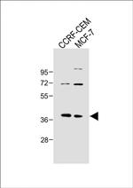 Mimecan Antibody in Western Blot (WB)