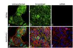 PALB2 Antibody