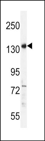 PALB2 Antibody in Western Blot (WB)