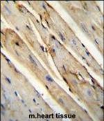 GAS1 Antibody in Immunohistochemistry (Paraffin) (IHC (P))