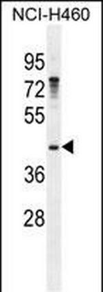 GAS1 Antibody in Western Blot (WB)