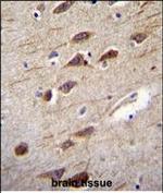 RUSC2 Antibody in Immunohistochemistry (Paraffin) (IHC (P))