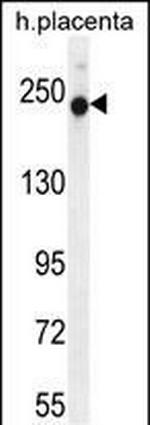 RUSC2 Antibody in Western Blot (WB)