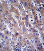 FADS2 Antibody in Immunohistochemistry (Paraffin) (IHC (P))