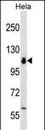 POLR1B Antibody in Western Blot (WB)