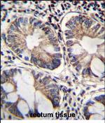 ME2 Antibody in Immunohistochemistry (Paraffin) (IHC (P))