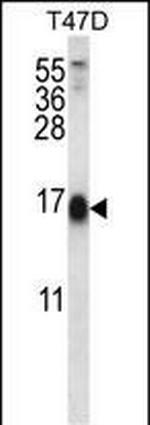 SKA2 Antibody in Western Blot (WB)