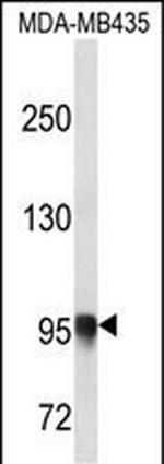 PLOD3 Antibody in Western Blot (WB)