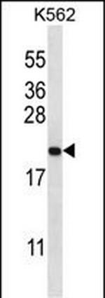 GAGE2B Antibody in Western Blot (WB)