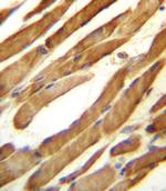 SLC16A10 Antibody in Immunohistochemistry (Paraffin) (IHC (P))